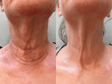 Neck