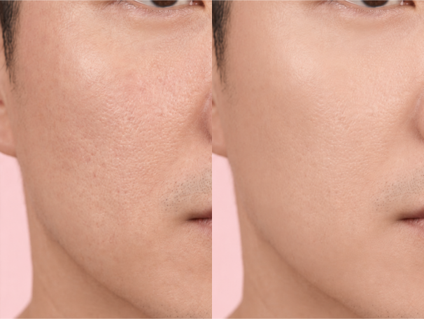 Full Face