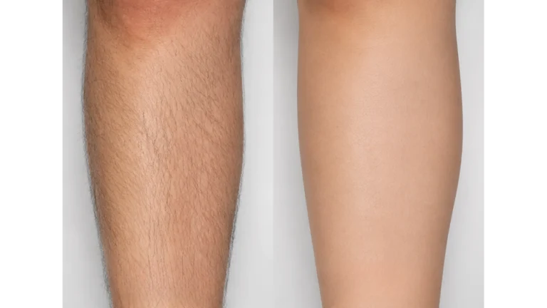 Leg