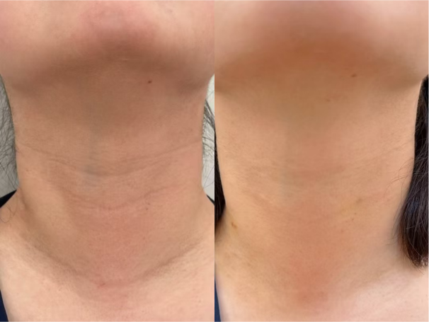 Neck