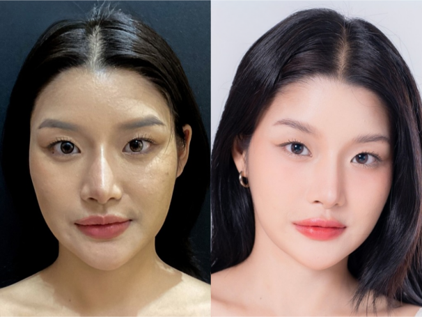 Full Face