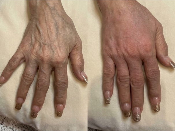 Hand