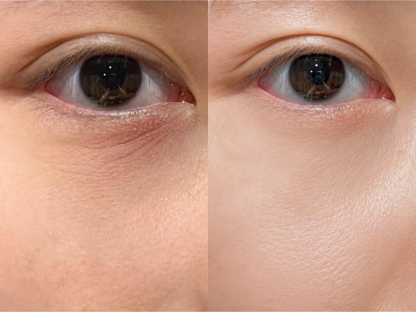 Under Eyes