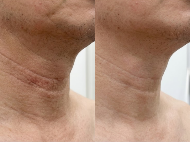 Neck