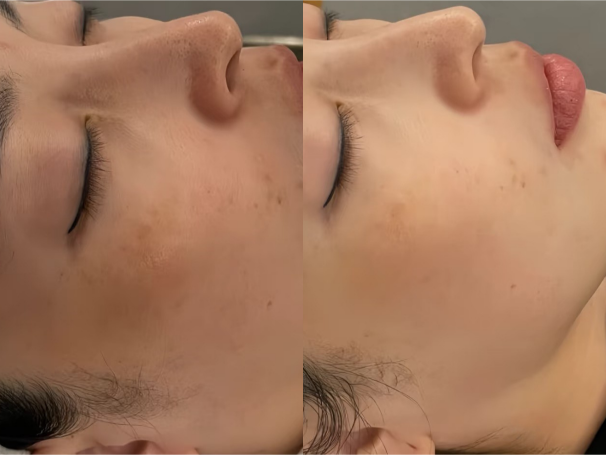 Full Face
