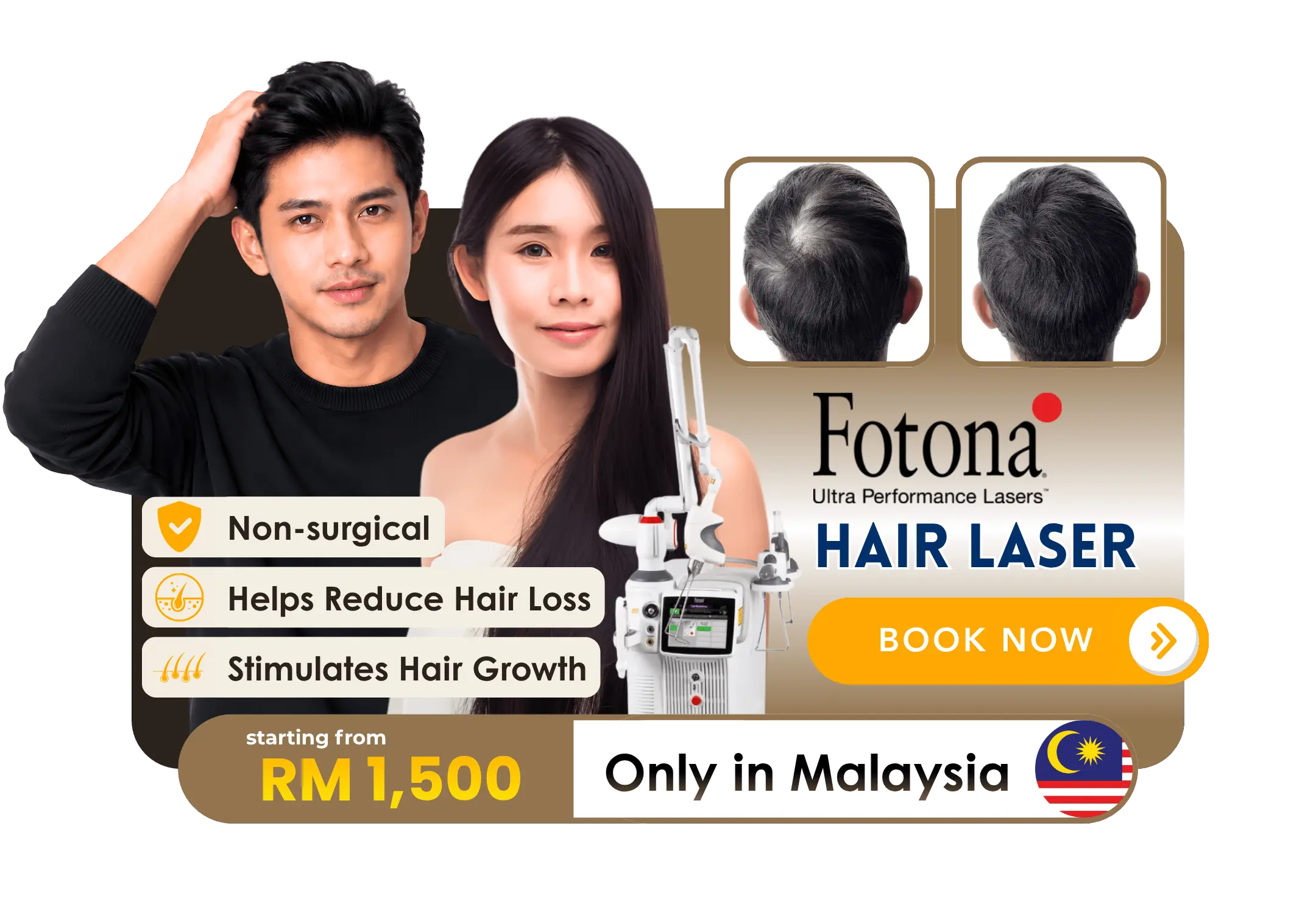Fotona Hair Laser exclusive offer