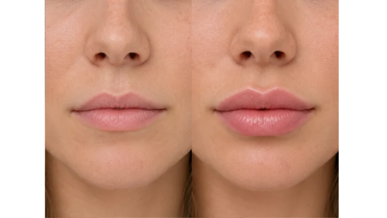 Lips